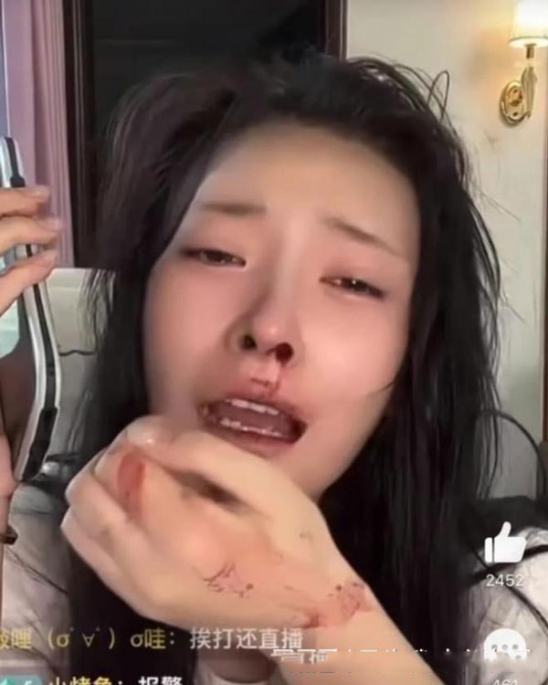 抖音女网红发视频表示自己被男友家暴，一边流血一边报警